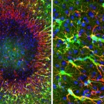 Adult Brain’s Hidden Repair System Revealed: Scientists Discover a New Ability to Heal Itself