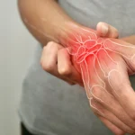 Dirty Air May Trigger Painful Rheumatoid Arthritis Flares